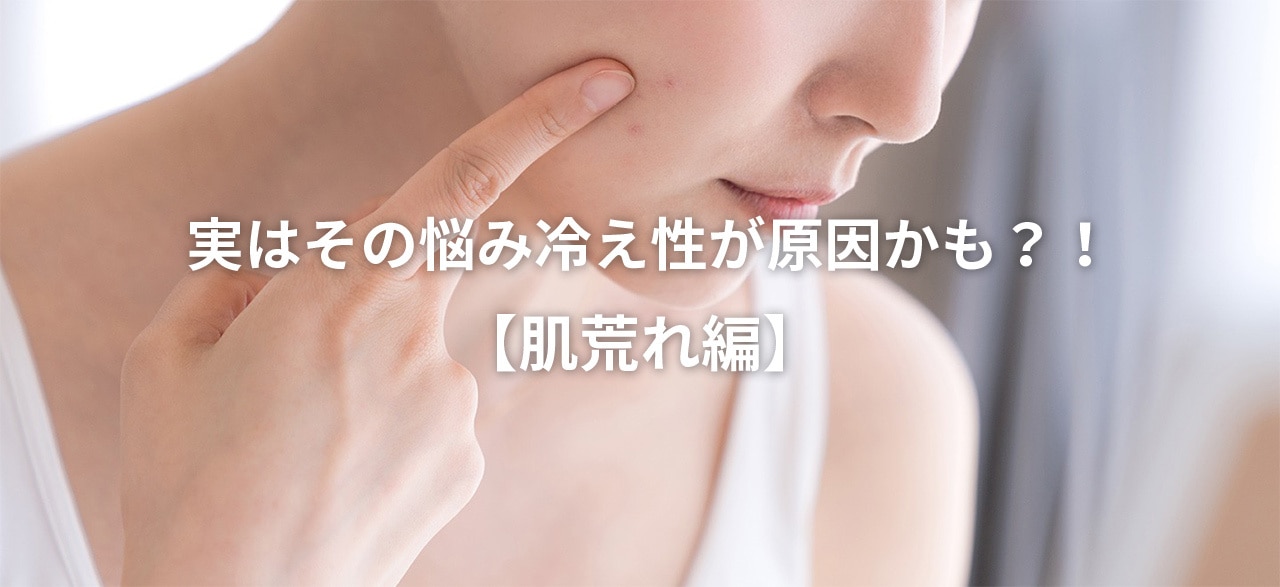 実はその悩み冷え性が原因かも？！【肌荒れ編】